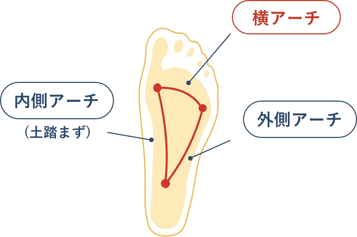 横アーチサポートの強化で母趾をサポート