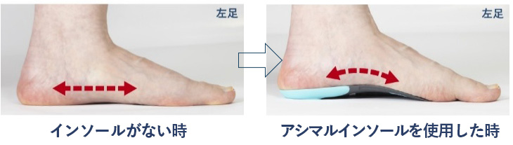 カカトが回内するとアーチが低下し身体のバランスが崩れる