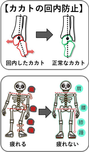 カカトが回内
