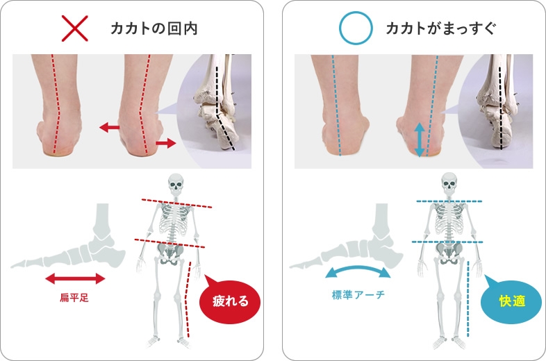 カカトの回内、カカトまっすぐ