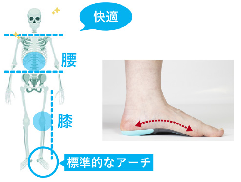 標準的なアーチ