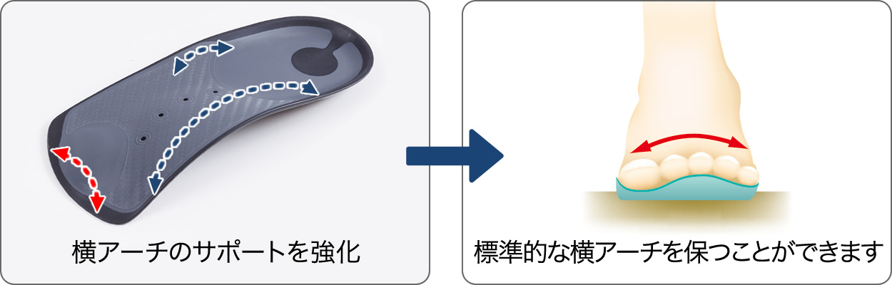 横アーチのサポートを強化→標準的なアーチを保つことができます