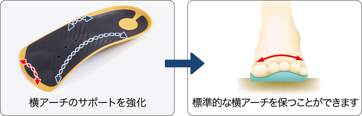 横アーチのサポートを強化→標準的なアーチを保つことができます