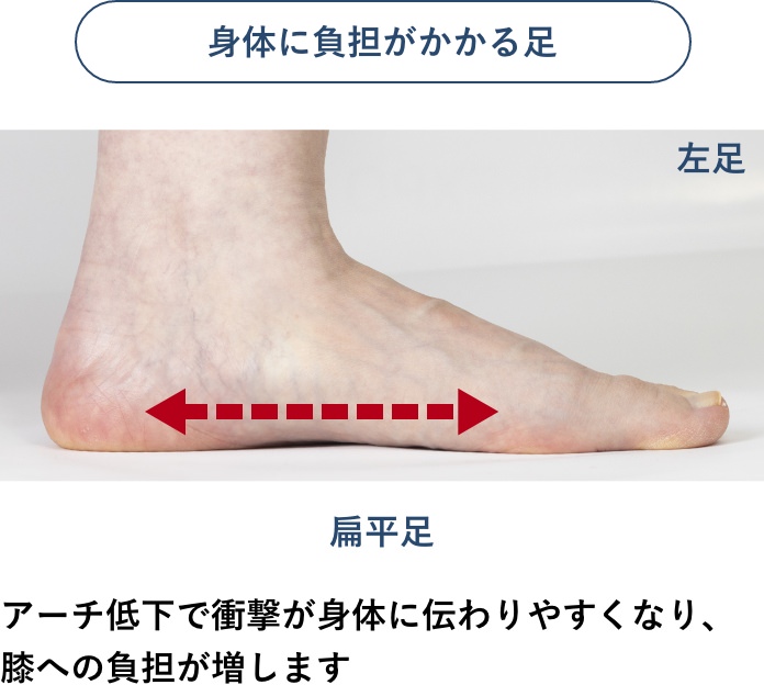身体に負担がかからない足