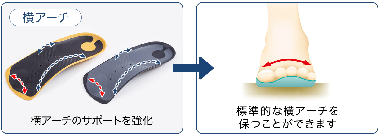 横アーチのサポートを強化