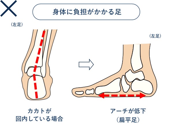 身体に負担がかかる足
