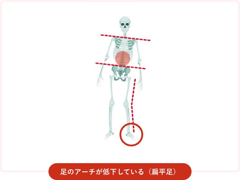 変形を起こしにくい驚異のスポンジ